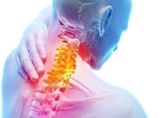 Osteocondrose