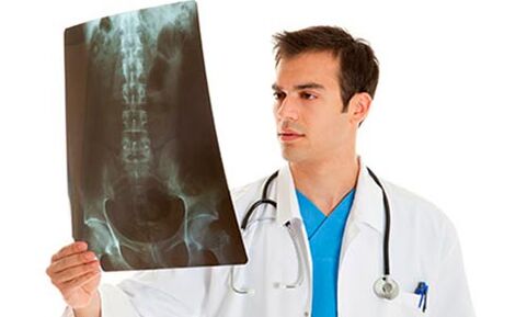 Médico mira radiografías para diagnosticar dor lumbar
